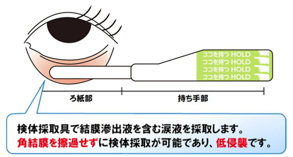 痛くないはやり目（流行性角結膜炎）の検査｜川口市の森田眼科