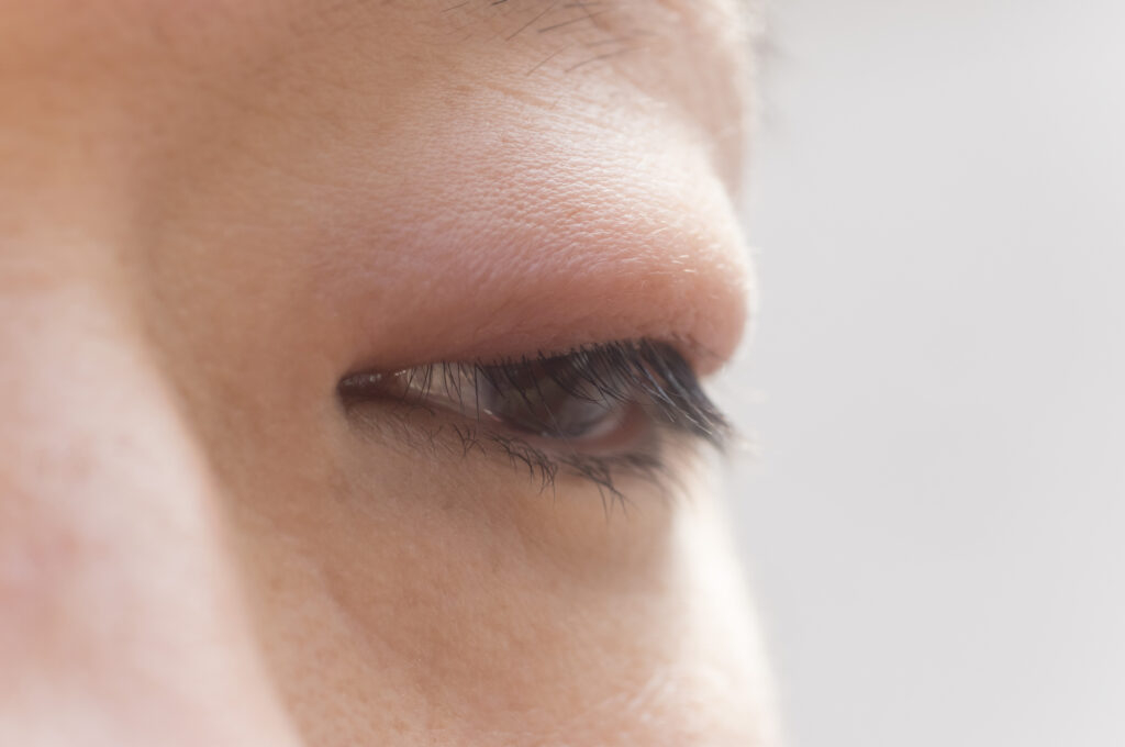 眼科専門医によるものもらい（麦粒腫・霰粒腫）の診察・検査の様子（川口市）