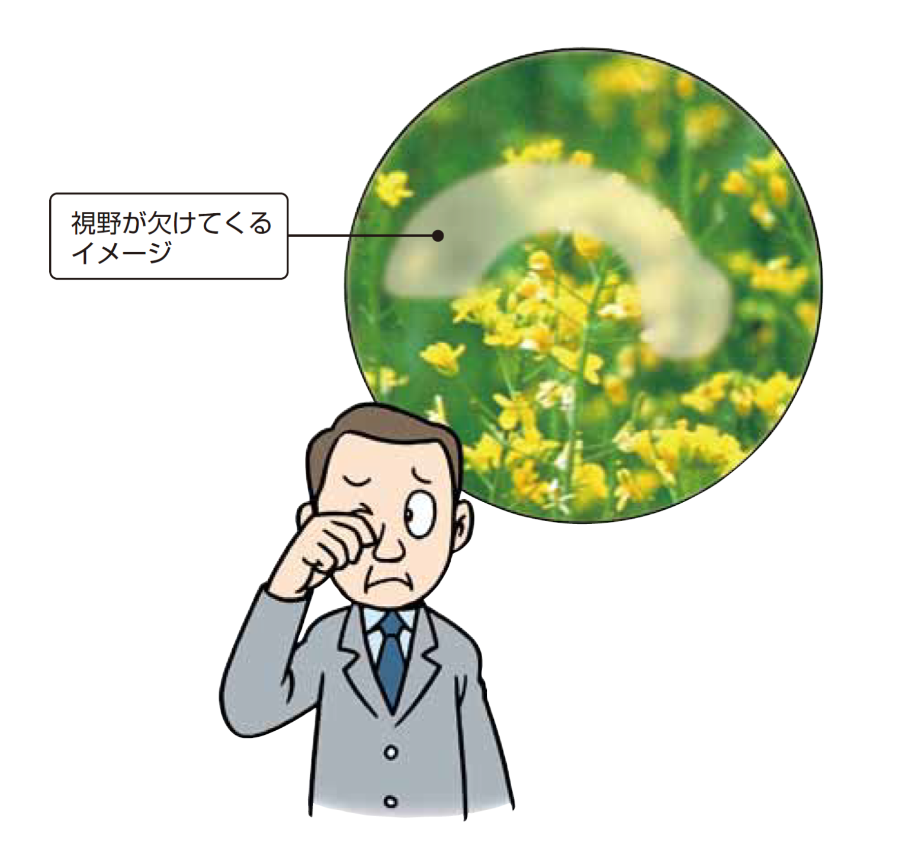 川口市】緑内障治療をお考えの方へ｜点眼・レーザー・手術まで一貫対応