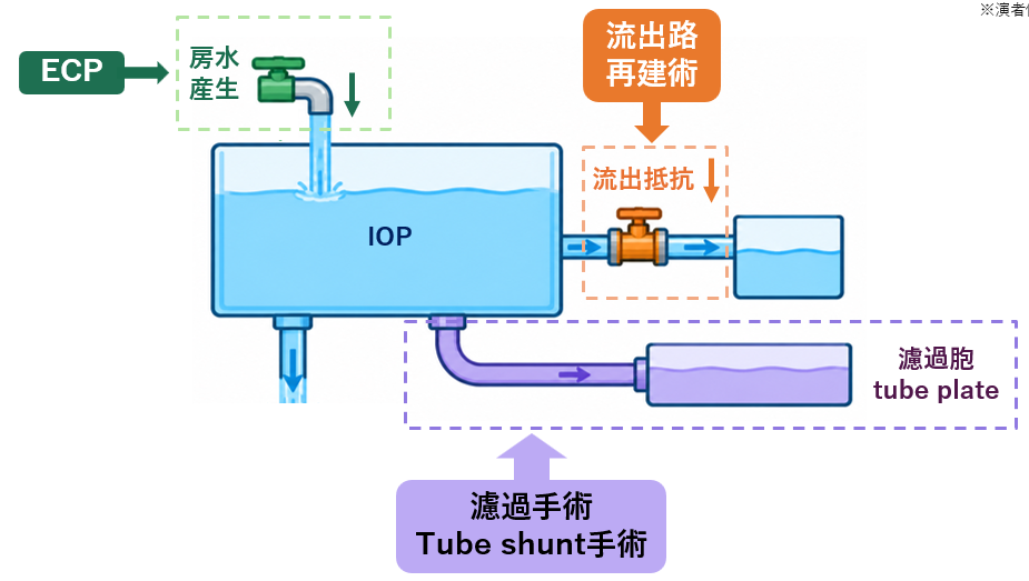 房水と眼圧のイメージ図|川口市森田眼科