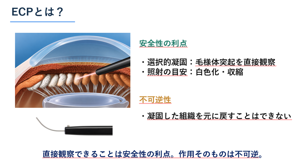 内視鏡的毛様体光凝固術(ECP)のイメージ図|川口市 森田眼科